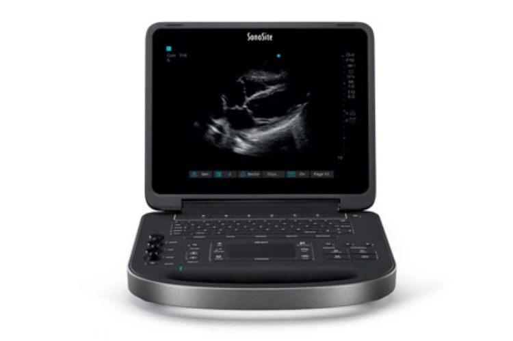 SonoSite Edge II <br> Ultrasound System </br>