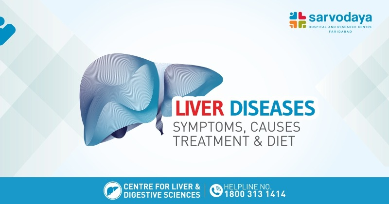 Liver Diseases - Symptoms, Causes, Treatment & Diet