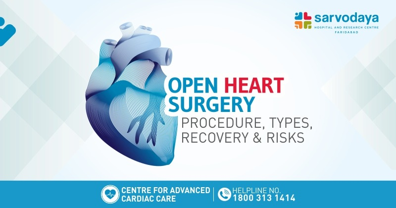Open Heart Surgery- Procedure, Types, Recovery & Risks