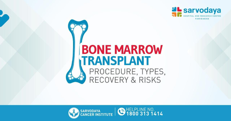 Bone Marrow Transplant: Procedure, Types & Risks