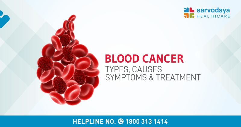 Blood Cancer - Types, Causes, Symptoms & Treatment