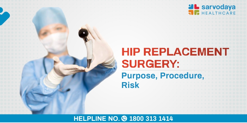 Hip Replacement Surgery - Purpose, Procedure, Risks