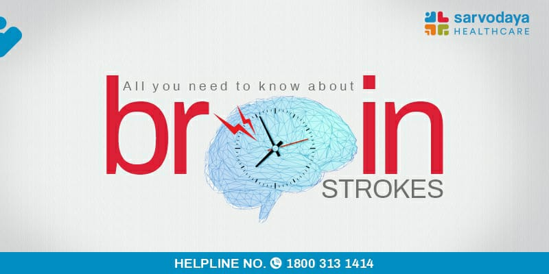 All you need to know about Brain Strokes