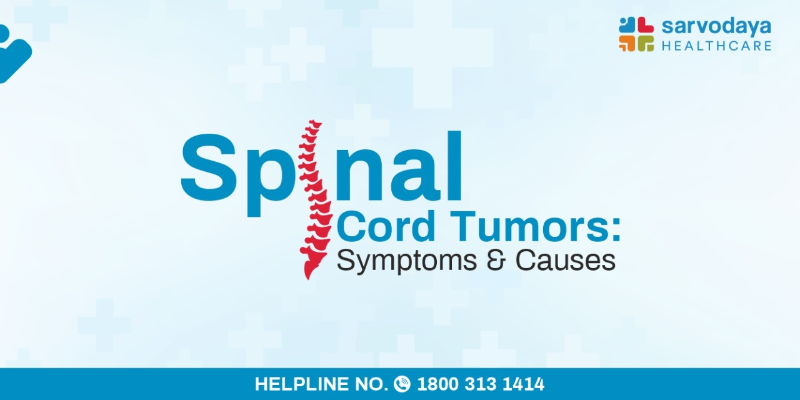 Spinal Cord Tumors - Symptoms and Causes 