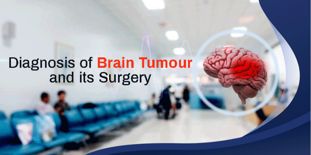 Diagnosis of Brain Tumor and its Surgery