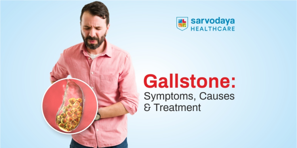 Gallstone Symptoms Causes and Treatment