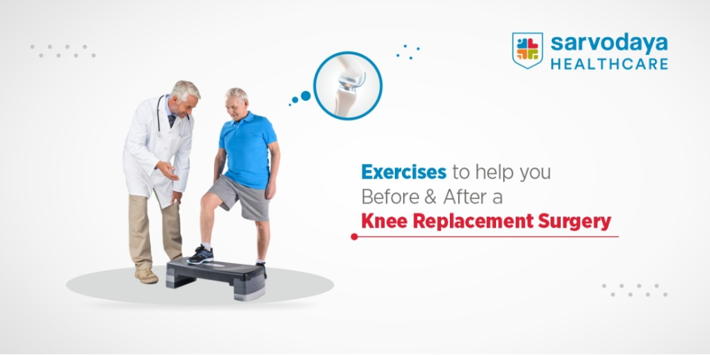 Exercises To Perform Pre & Post A Knee Replacement Surgery