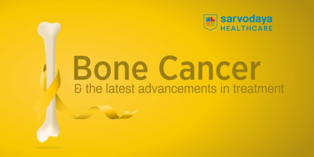 Bone Cancer and the Latest Advancements in Treatment